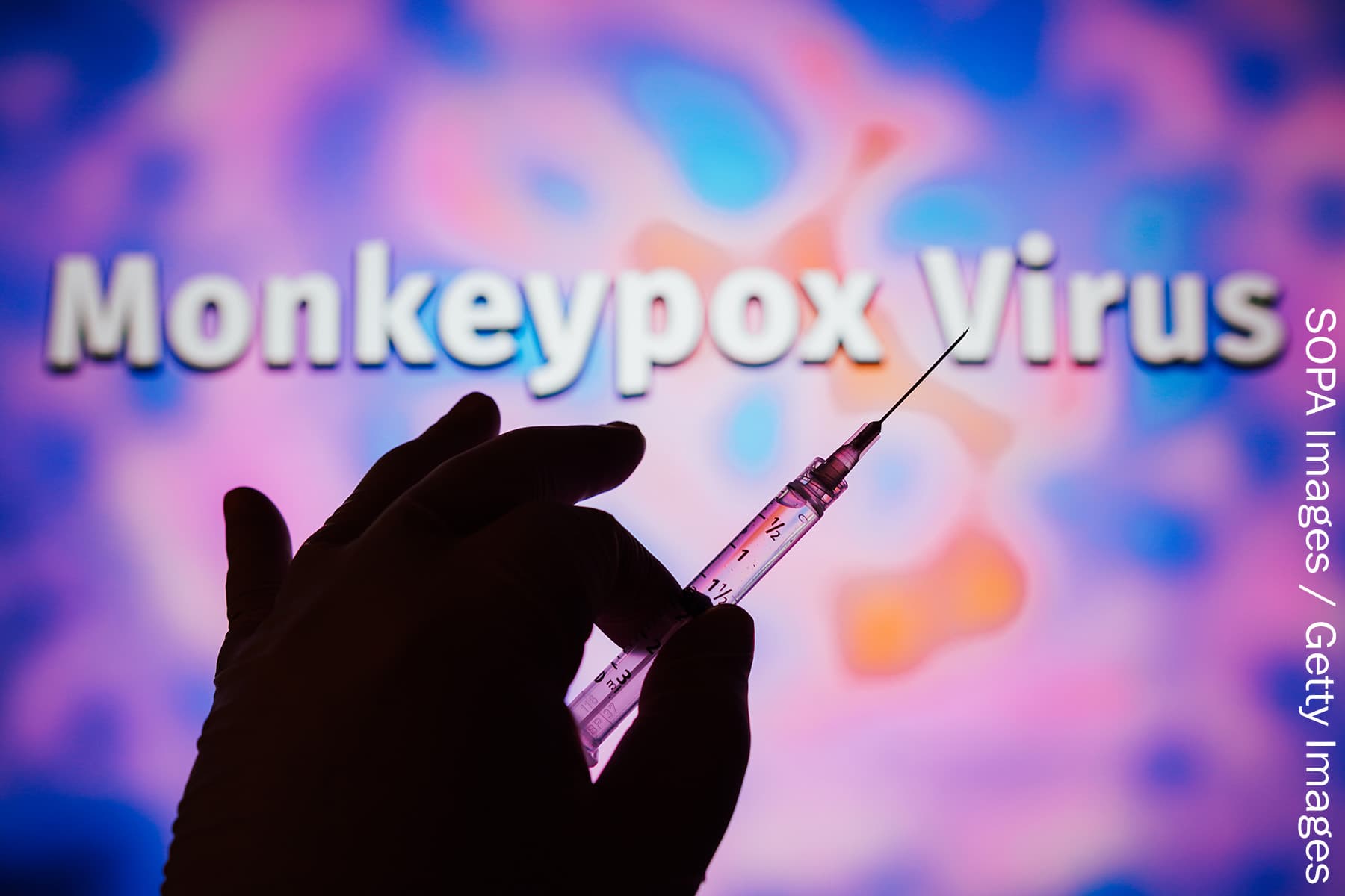 Monkeypox Might Get New Title to Curb Stigma Monkeypox Might Get New Title to Curb Stigma