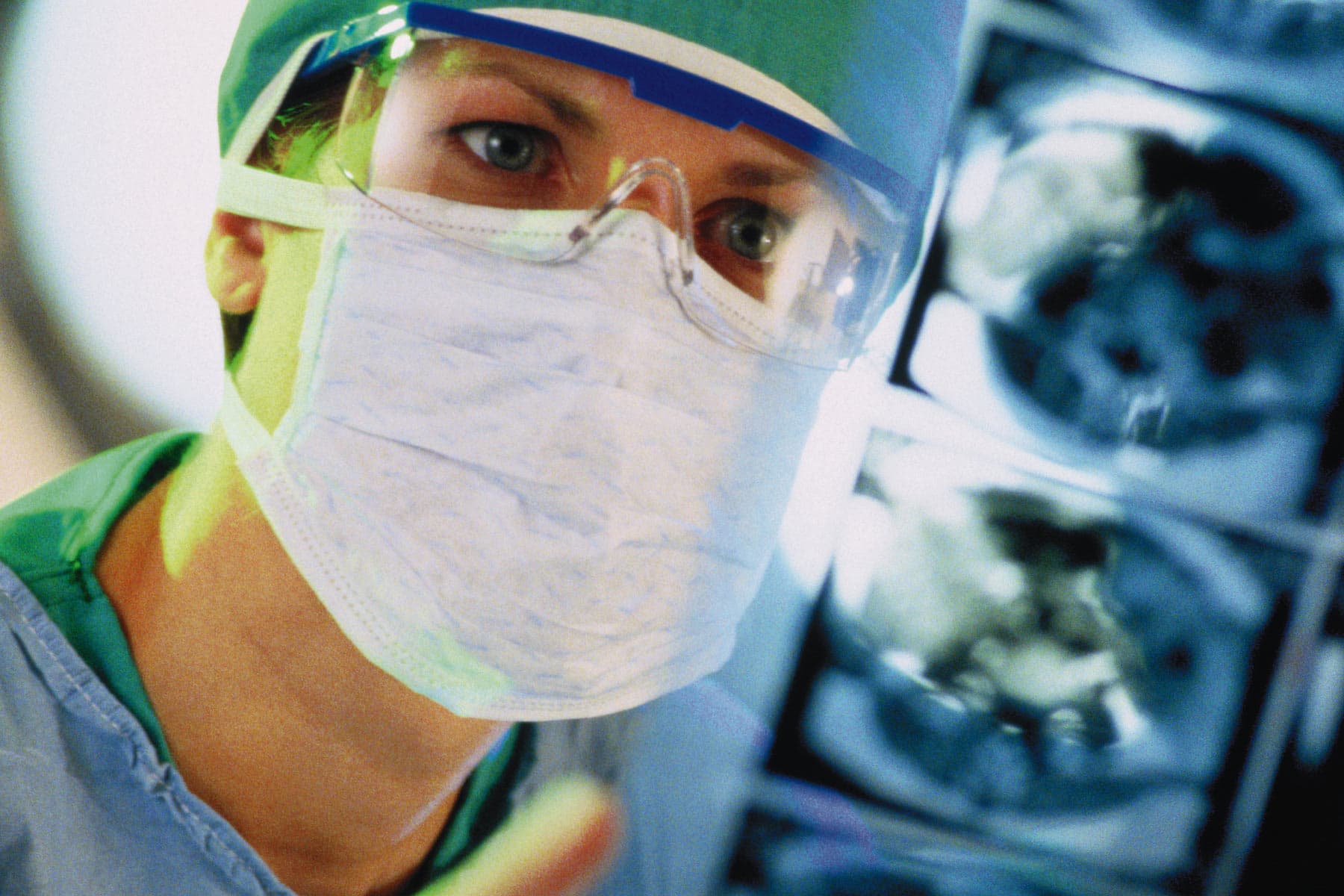 PFAS ‘Without end Chemical compounds’ Are Linked With Liver Most cancers