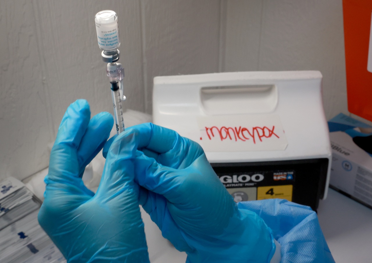 Monkeypox known as MPX by California Division of Well being