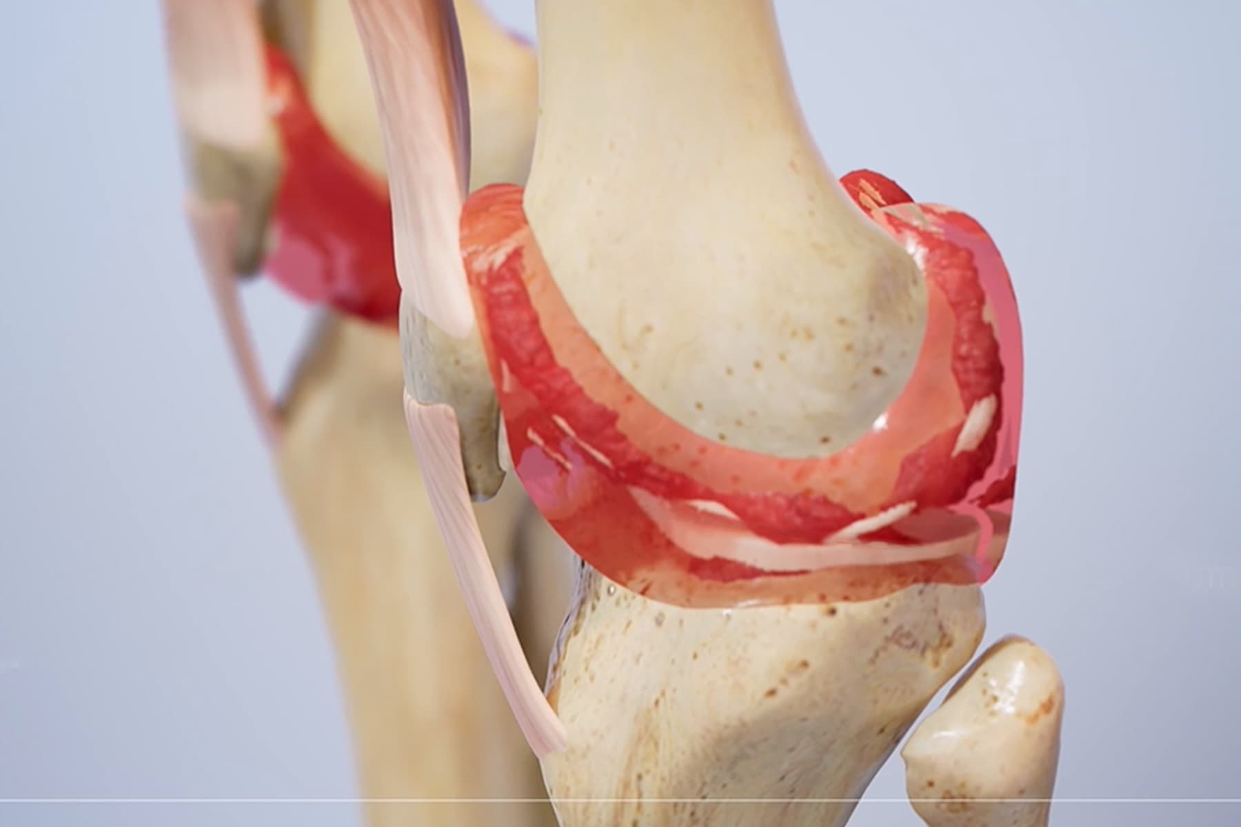 Most People Over 50 Undergo Some Kind of Joint Ache (Ballot) Most People Over 50 Undergo Some Kind of Joint Ache (Ballot)