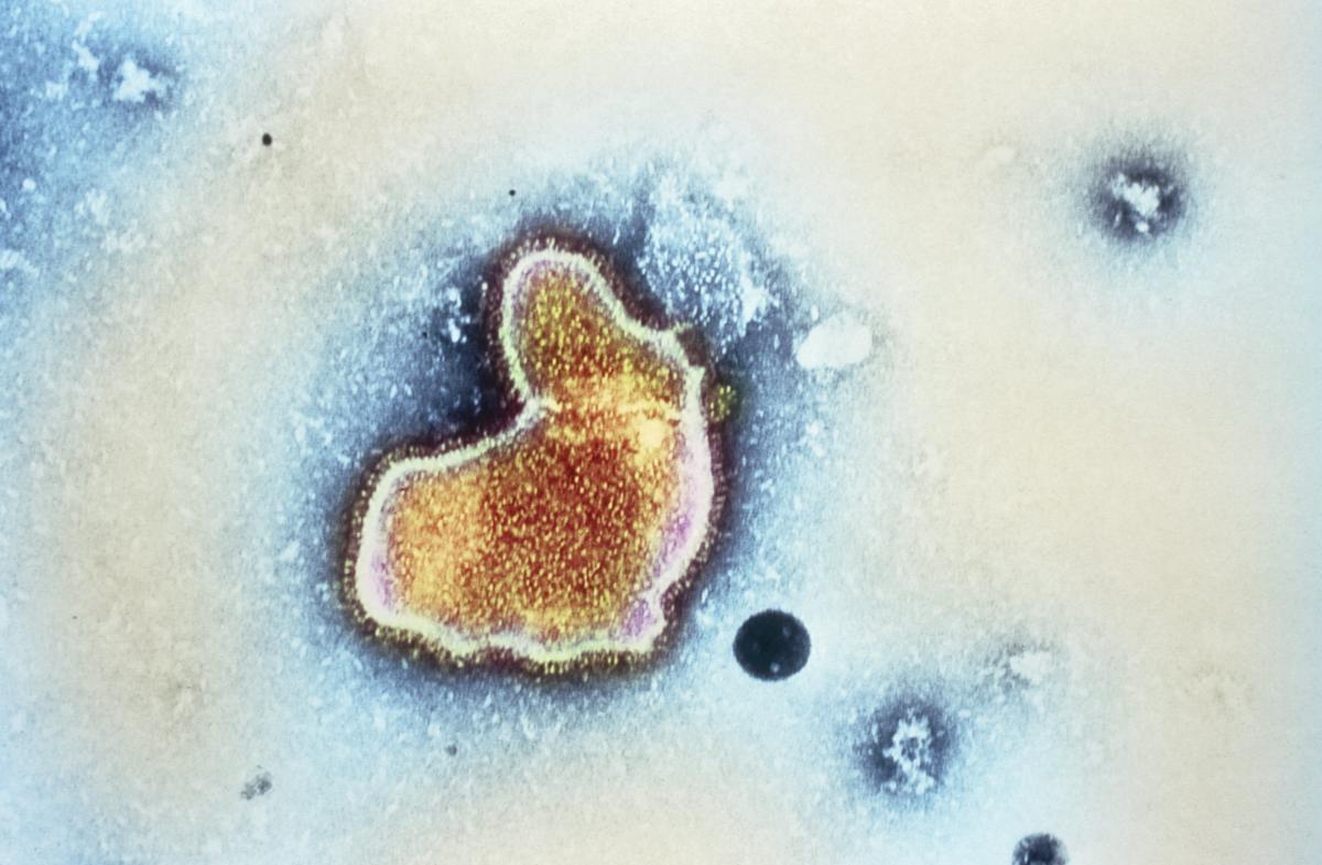 Pfizer’s RSV vaccine for pregnant girls protects newborns towards extreme sickness