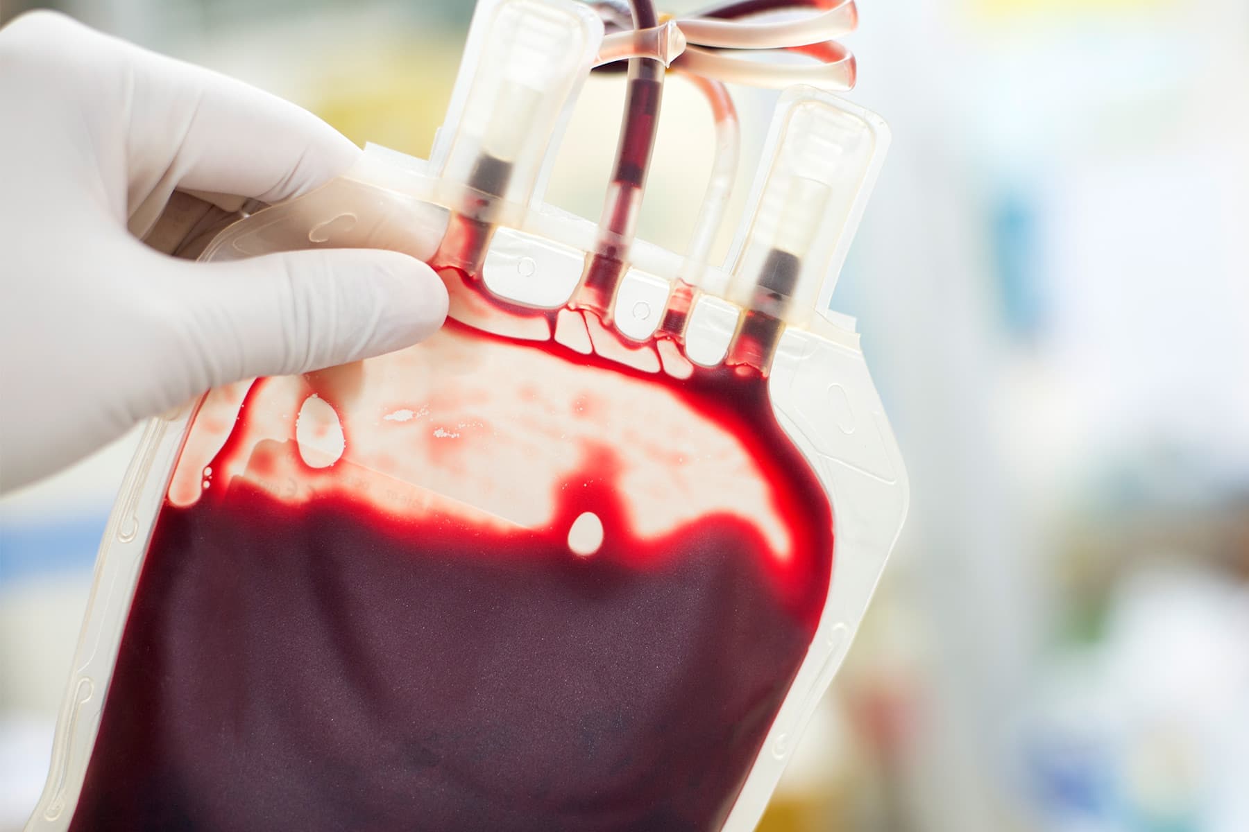 FDA Strikes to Ease Restrictions on Homosexual Males Giving Blood