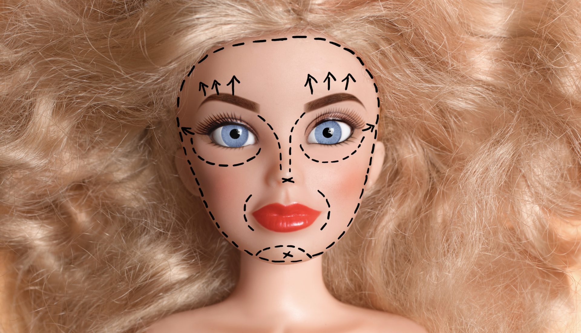Buccal Fats Elimination? Twitter Critiques New Plastic Surgical procedure Development
