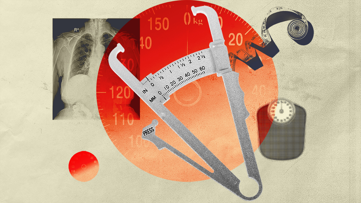The AMA says BMI is dangerous solution to measure weight and well being