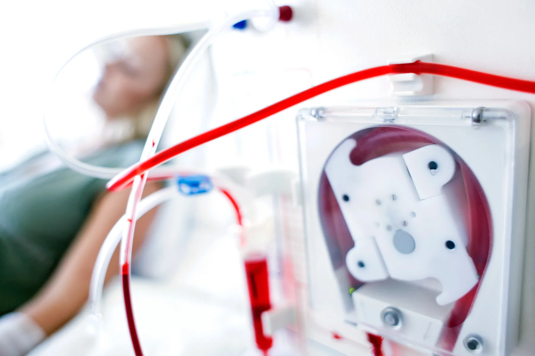 My Dialysis Machine Works as My Kidneys, for Now My Dialysis Machine Works as My Kidneys, for Now