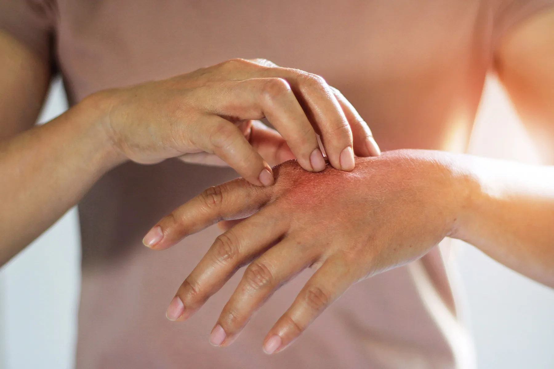 Winter Pores and skin Woes? Right here’s What to Do – and What To not Do