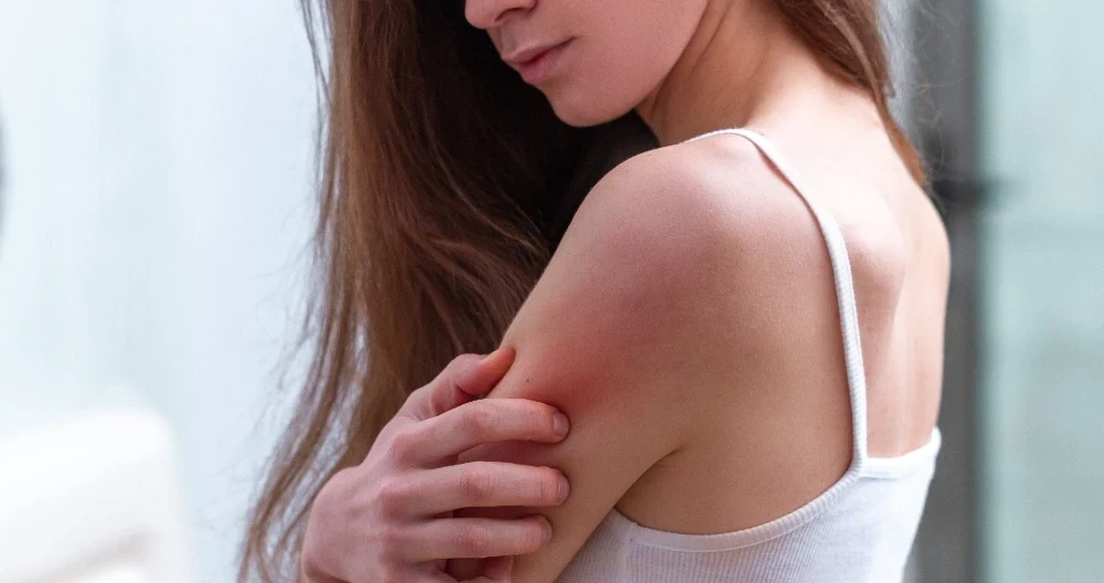 Researchers uncover the stunning reason for itchy pores and skin