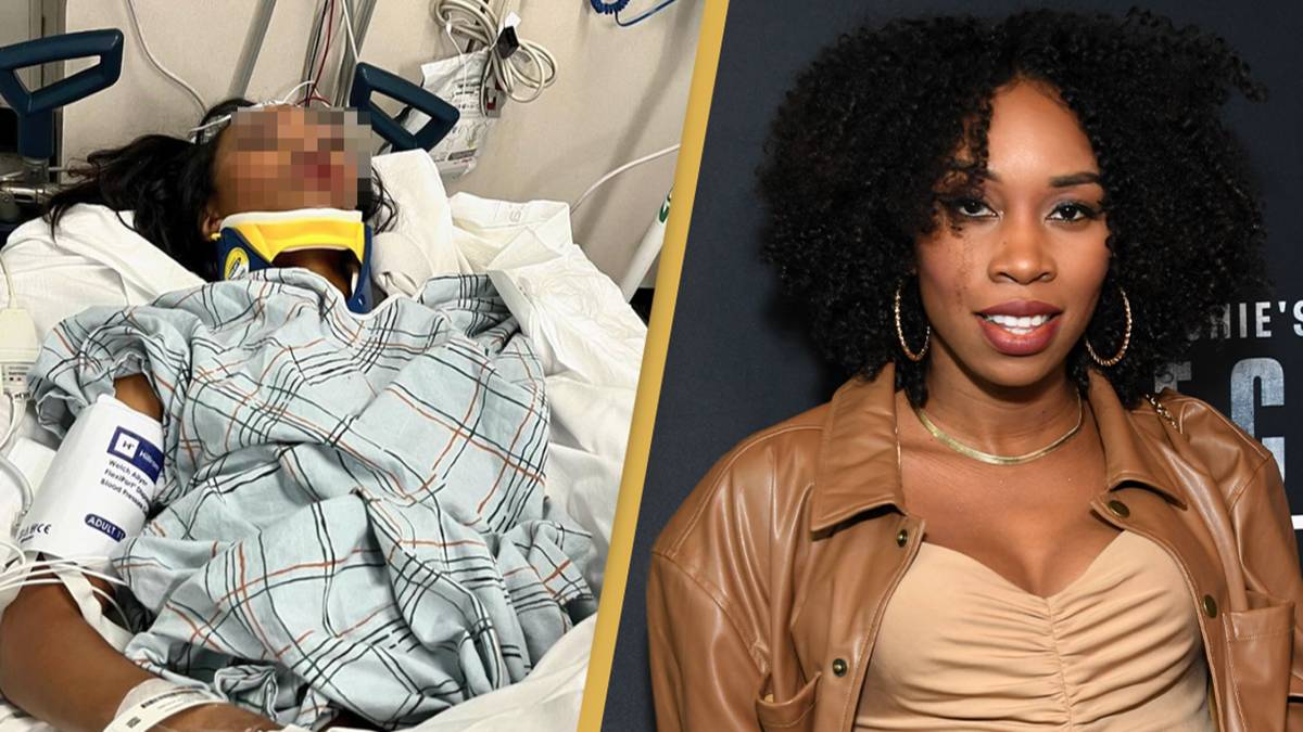 Black Panther star Carrie Bernans unable to stroll unaided after being knocked unconscious in ‘hit and run’