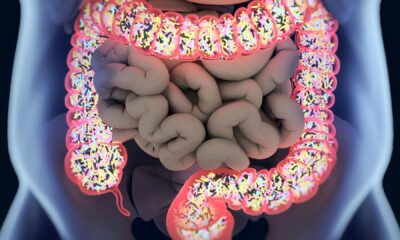 Specializing in Intestine Well being Can Assist Weight Loss