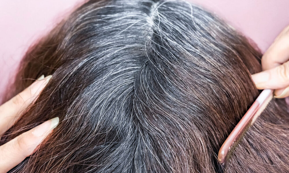 A Physician Shares The Finest Methods To ‘Naturally Reverse Grey Hairs’ With out Utilizing ‘Harmful’ Poisonous Hair Dyes