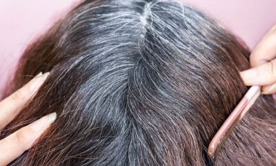 A Physician Shares The Finest Methods To ‘Naturally Reverse Grey Hairs’ With out Utilizing ‘Harmful’ Poisonous Hair Dyes