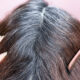 A Physician Shares The Finest Methods To ‘Naturally Reverse Grey Hairs’ With out Utilizing ‘Harmful’ Poisonous Hair Dyes A Physician Shares The Finest Methods To ‘Naturally Reverse Grey Hairs’ With out Utilizing ‘Harmful’ Poisonous Hair Dyes