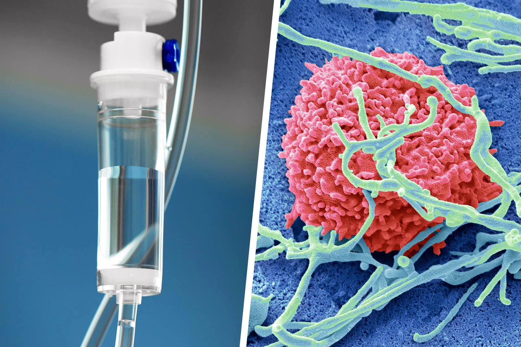 This Mutation Doubtless Saved a Colon Most cancers Affected person’s Life This Mutation Doubtless Saved a Colon Most cancers Affected person’s Life