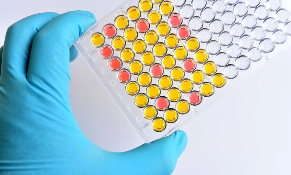 How Is Pompe Illness Identified?