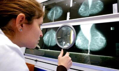 Widespread Chemical compounds: Breast Most cancers Hyperlink?