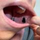 Hate Taking Drugs? For Some Medication, You Gained’t Want To