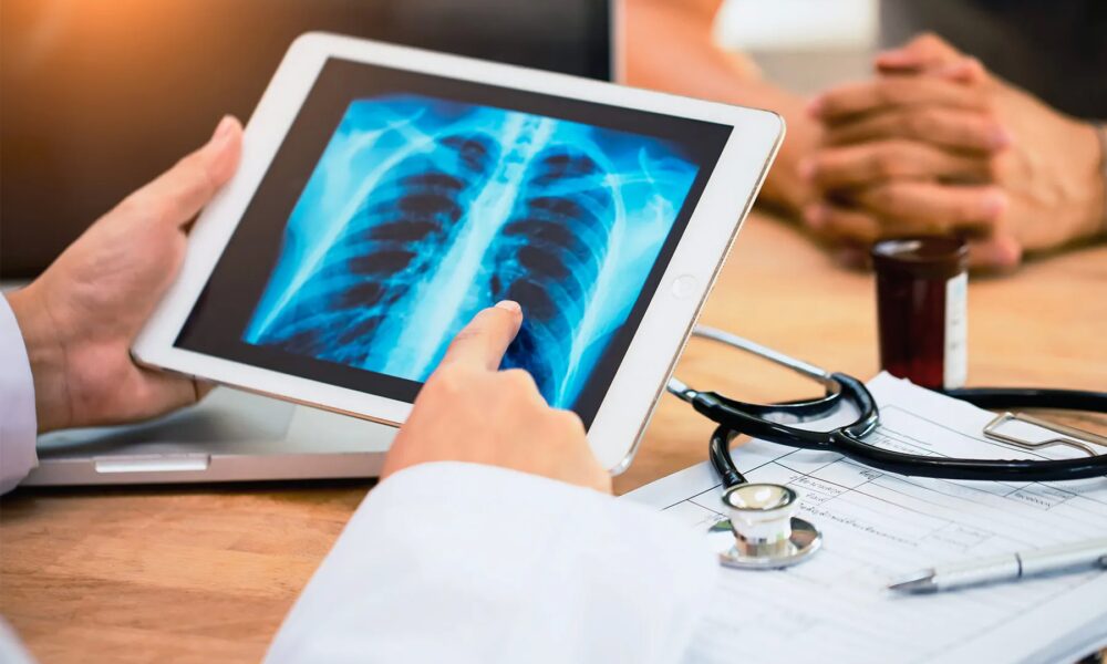 Getting Most cancers Care in Rural America