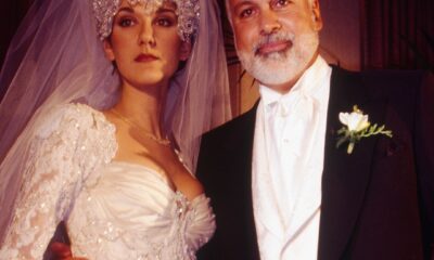 Why Céline Dion Had Egg-Sized Harm on Her Face After Marriage ceremony Day