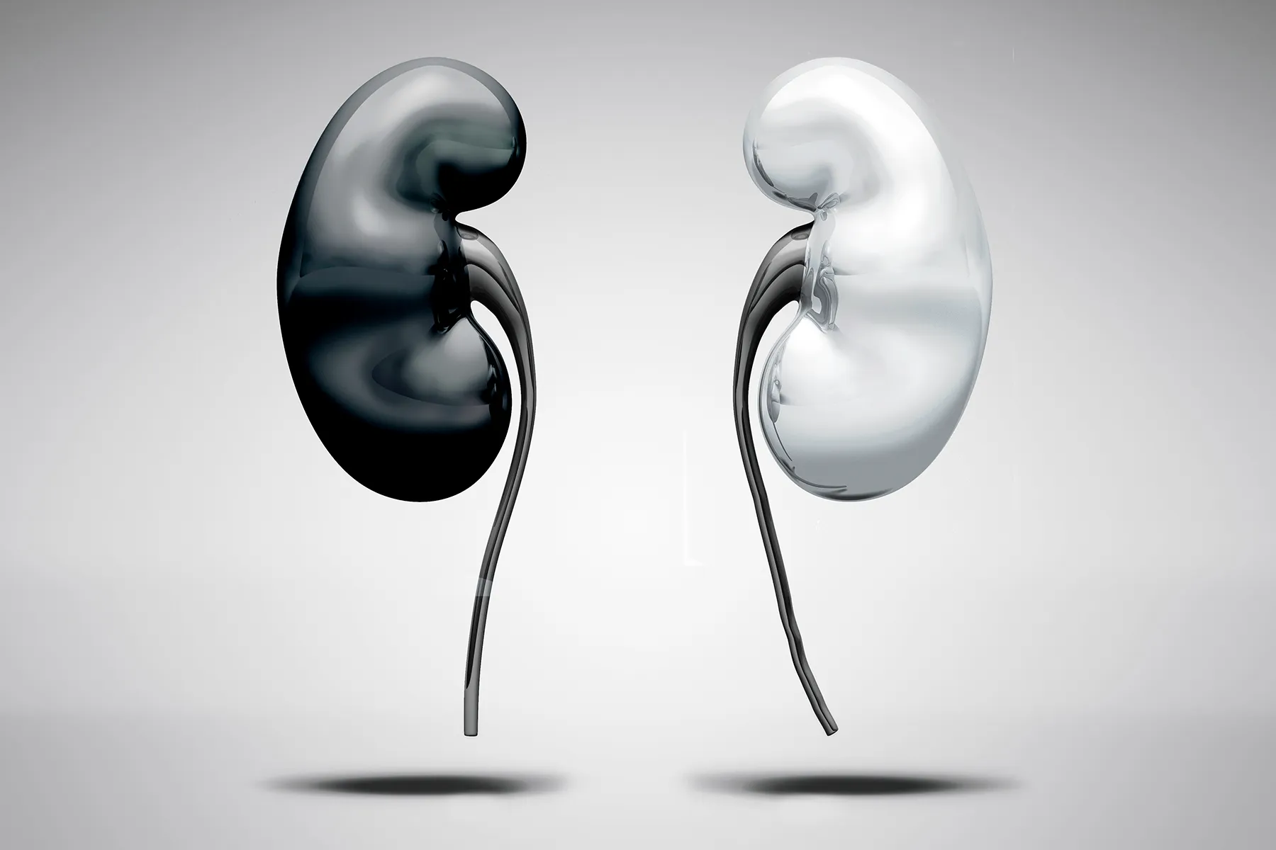 Taking Racism out of the Kidney Illness Equation