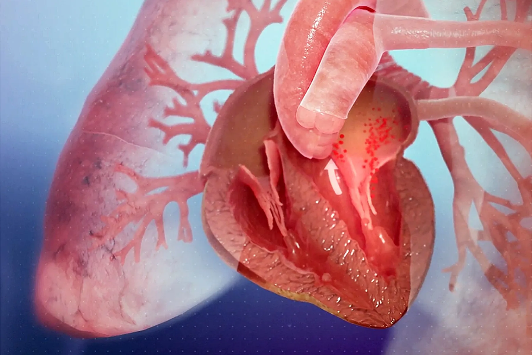 What’s Behind Main Rise in Coronary heart Failure Deaths? What’s Behind Main Rise in Coronary heart Failure Deaths?