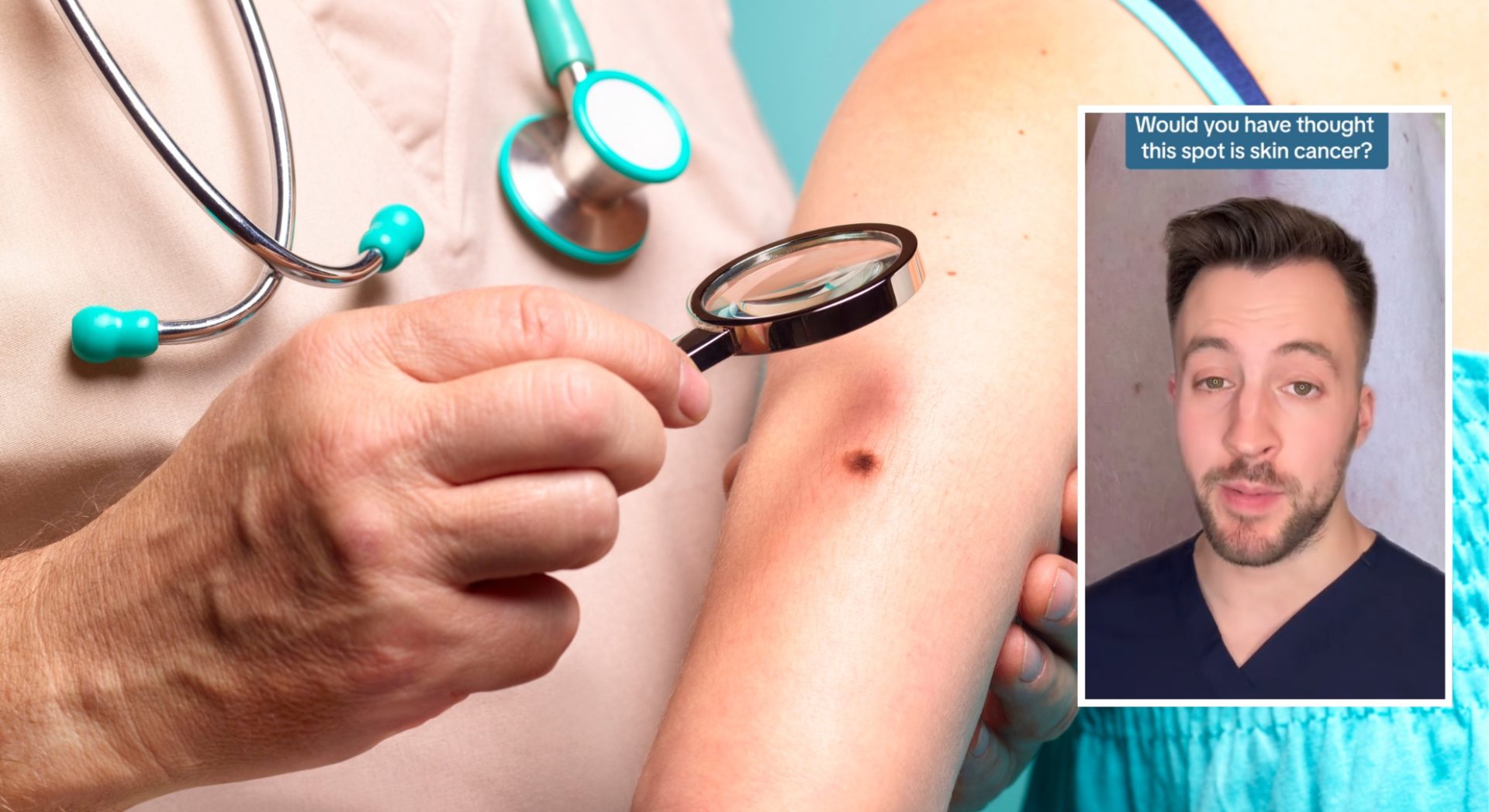 Dermatologist highlights one uncommon pores and skin most cancers symptom you want to pay attention to