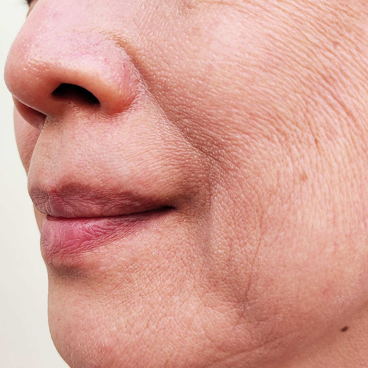 A Board-Licensed Derm Shares How To Forestall ‘Pores and skin-Thinning’ And ‘Enhance Collagen’ For Mature Pores and skin