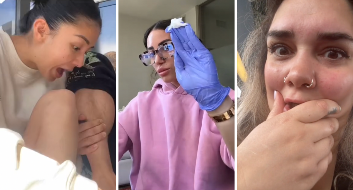 Viral TikTok development consultants warn might result in amputation: ‘Very harmful’