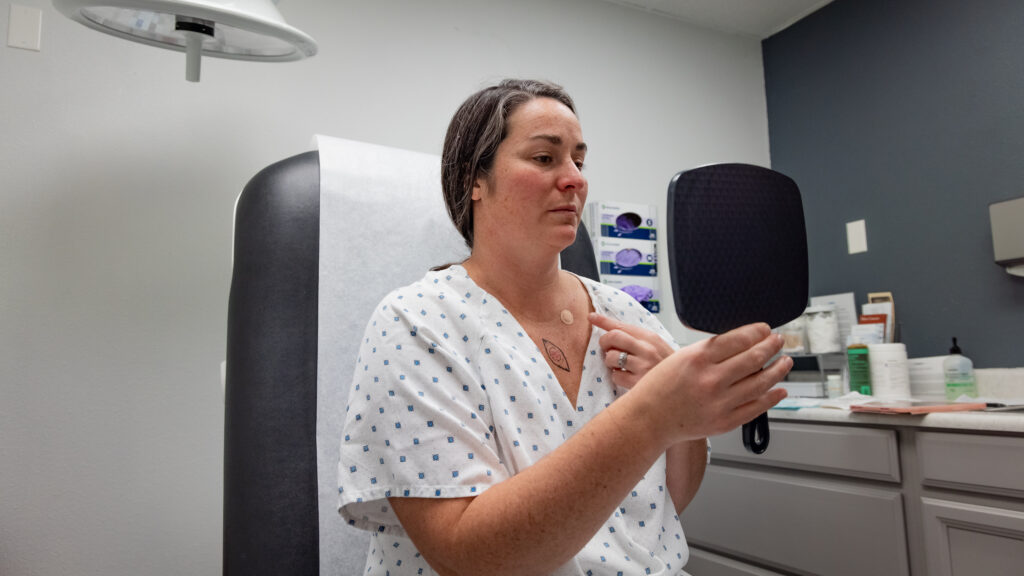 The emotional toll of pointless radiation remedy tattoos