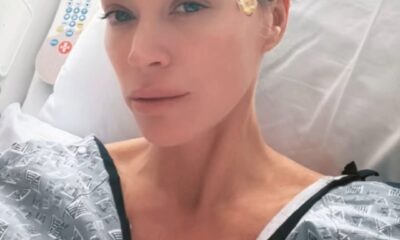 Teddi Mellencamp Particulars Hair Loss Amid Most cancers Remedy