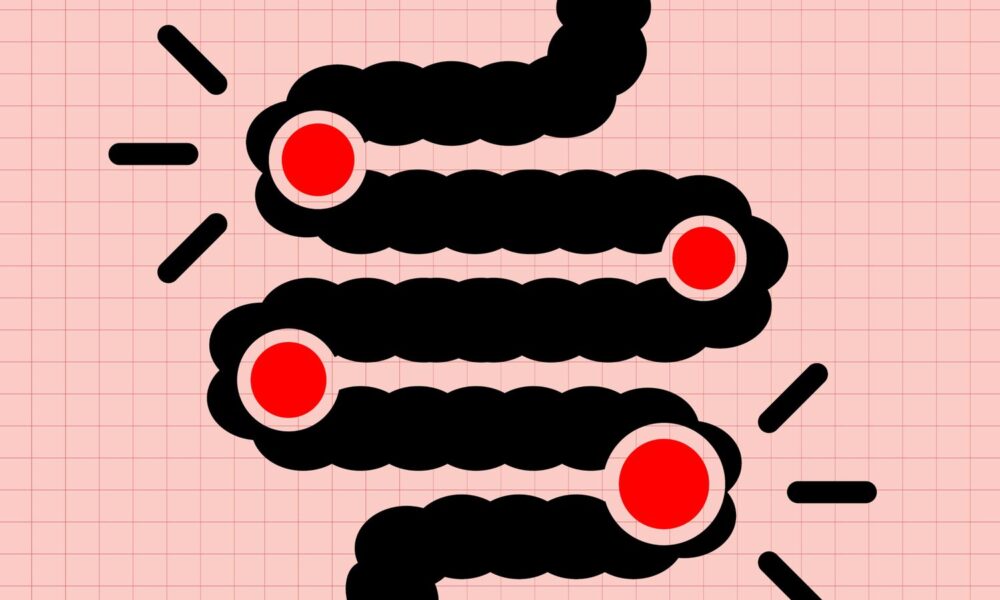 Acidogenic Meals Could Elevate Your Most cancers Danger