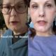 TikToker Michelle Wooden’s Facelift Pictures: Earlier than and After
