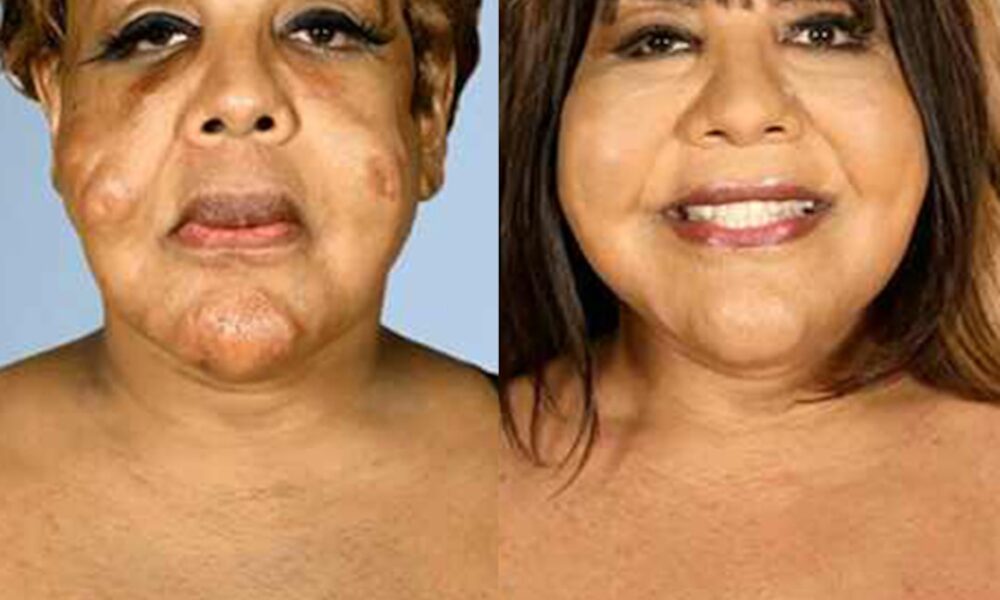 Botched Plastic Surgical procedure Earlier than and After Pics