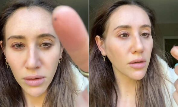 Girl Wakes As much as Tick in Her Eye After Spending Hours Doing Yard Work (Unique)